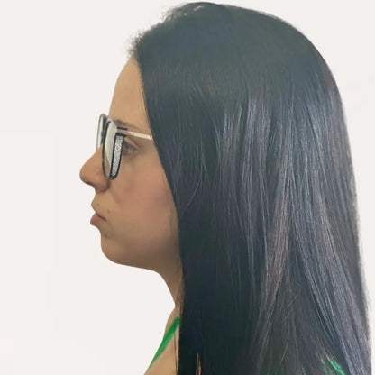 Crystal Elite Vision – Occhiali Multifocali